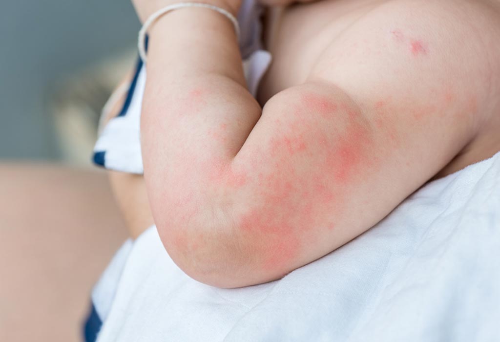 Pediatric Skin Care in Dindigul